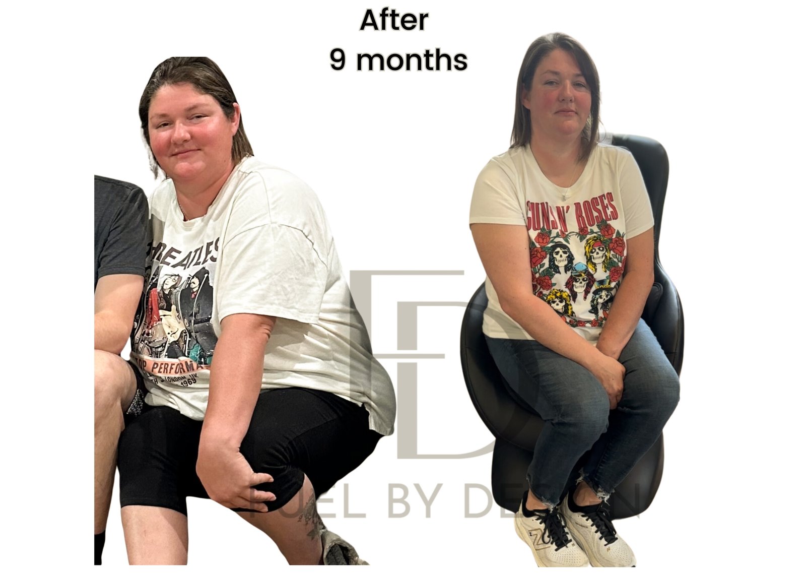 Fuel by Design before and after patient result 5