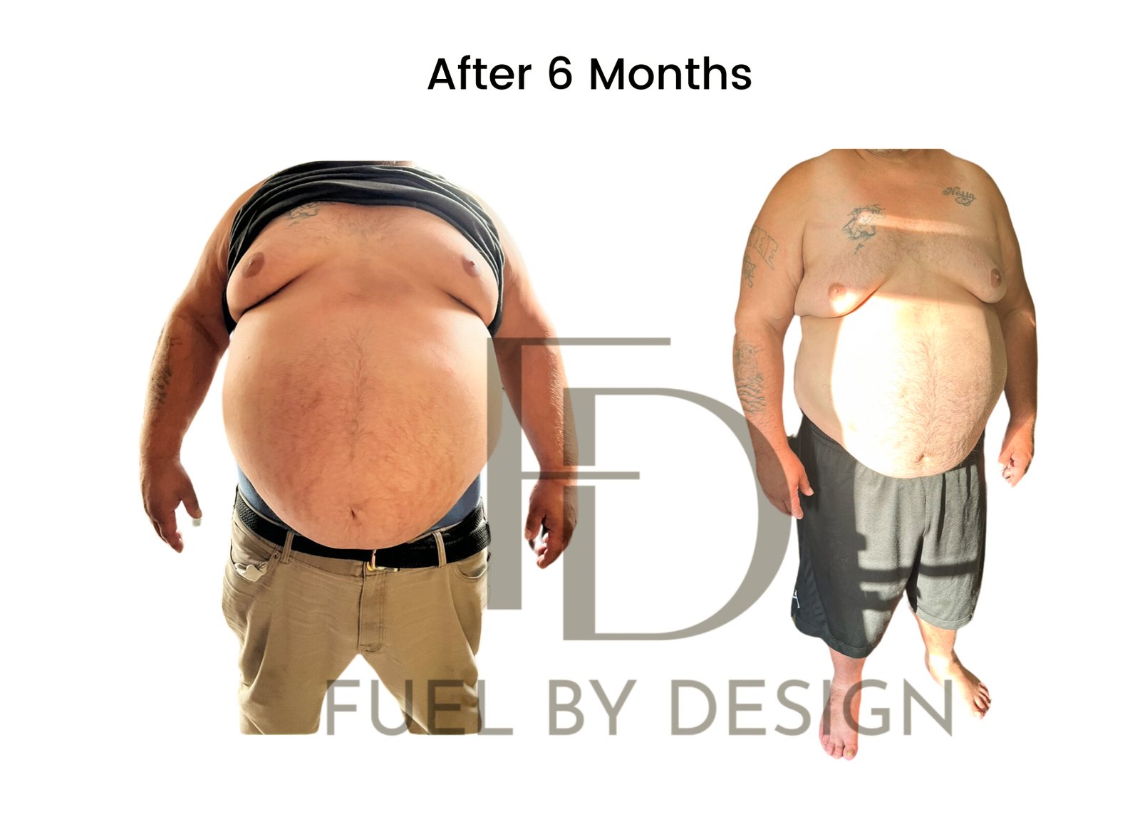 Fuel by Design before and after patient result 6